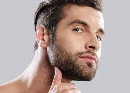 Beard Transplantation