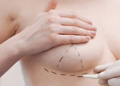 Breast Aesthetics