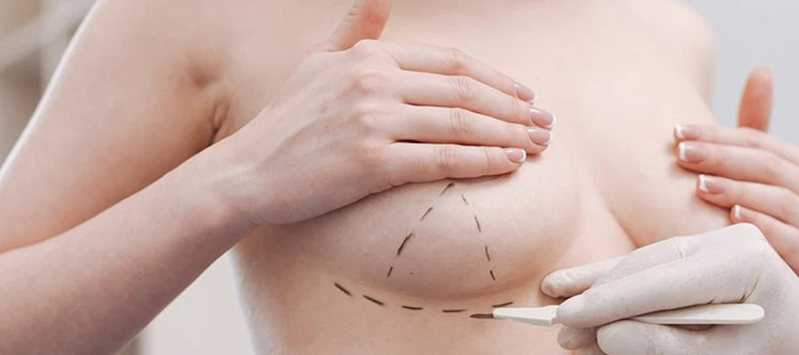 Breast Aesthetics