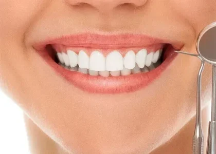 Dental Aesthetics