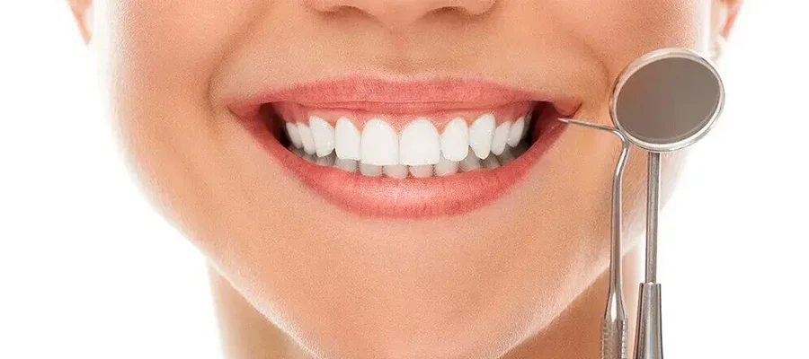 Dental Aesthetics