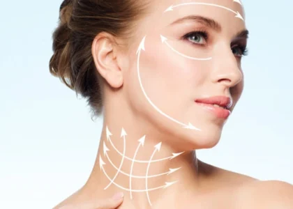 Face and Neck Lift