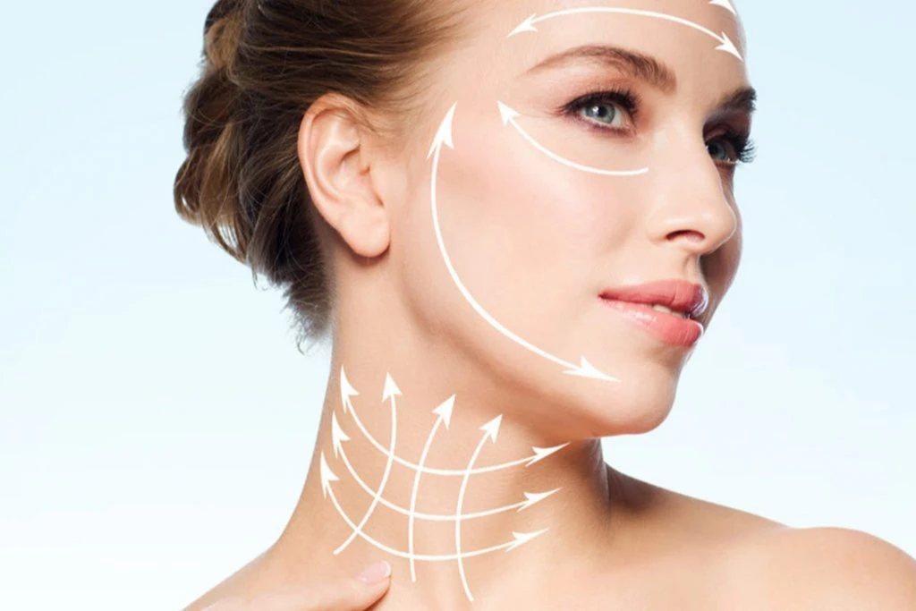 Face and Neck Lift