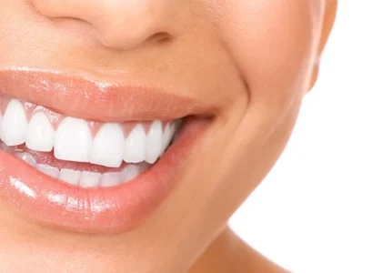Gum Aesthetics
