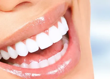 Hollywood Smile