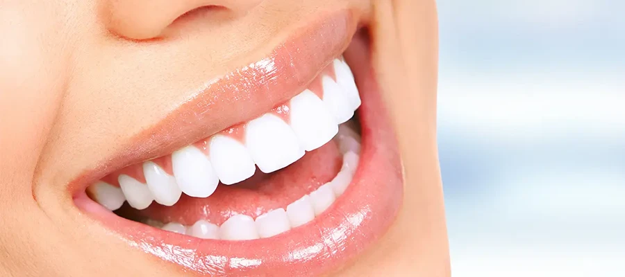 Hollywood Smile