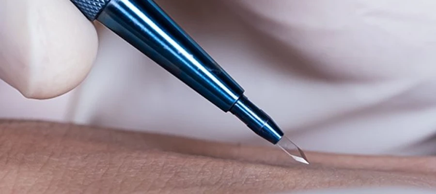 sapphire hair transplant